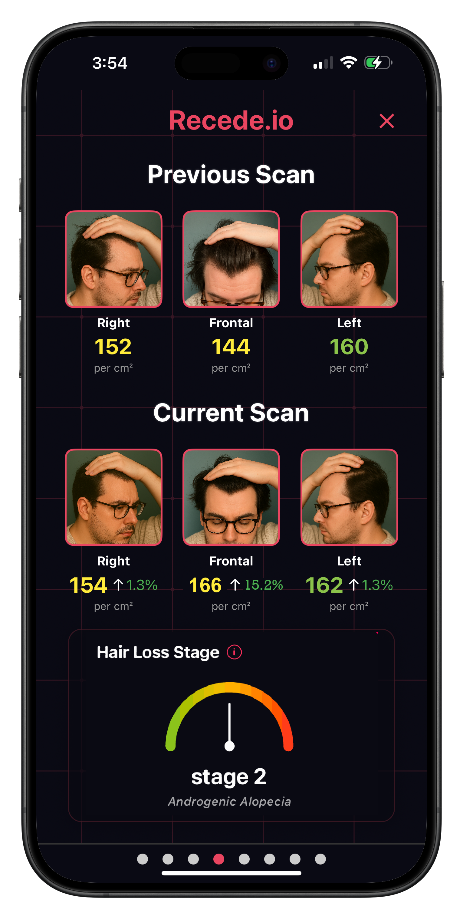 Recede.io App Features