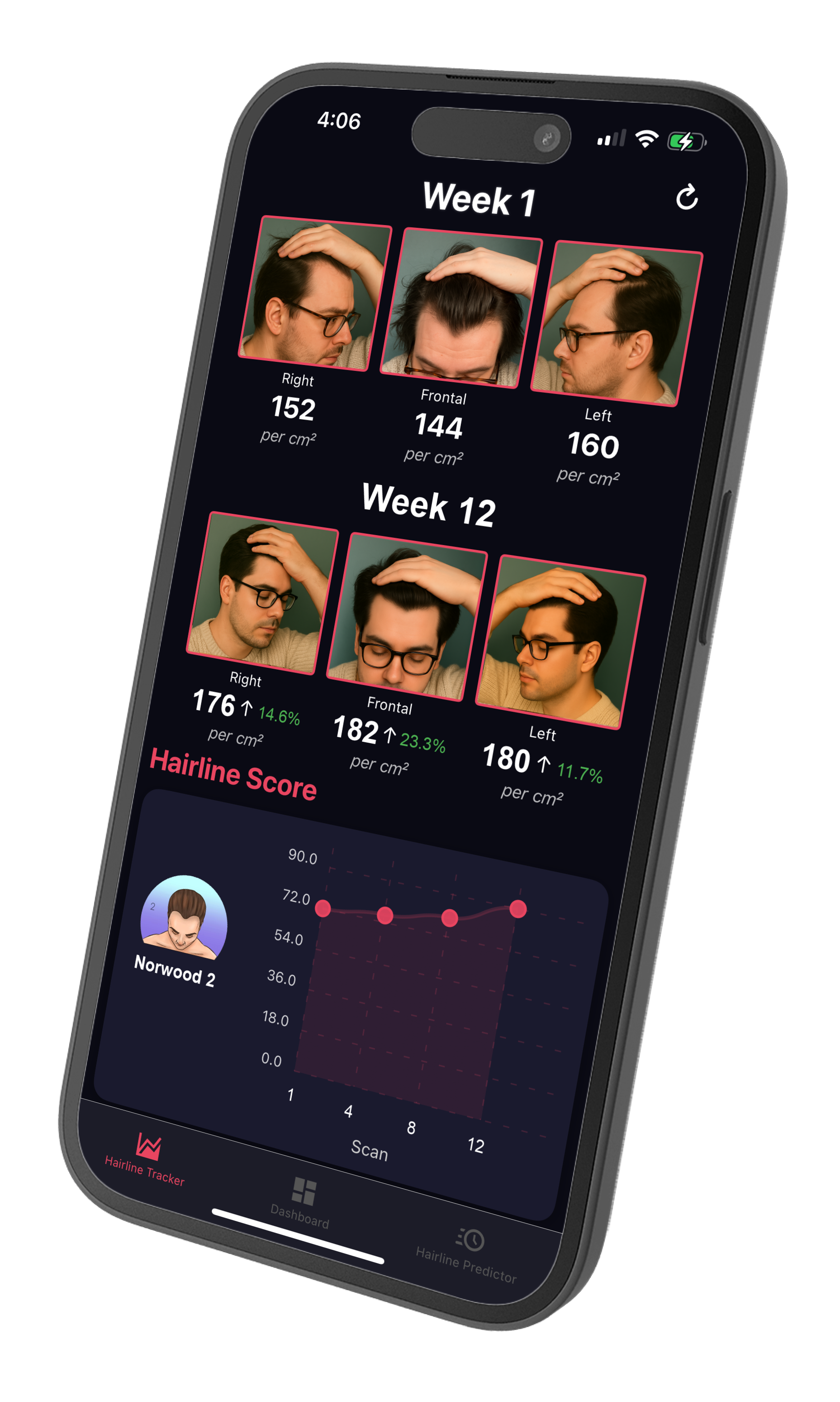 Track Growth - Phone 9